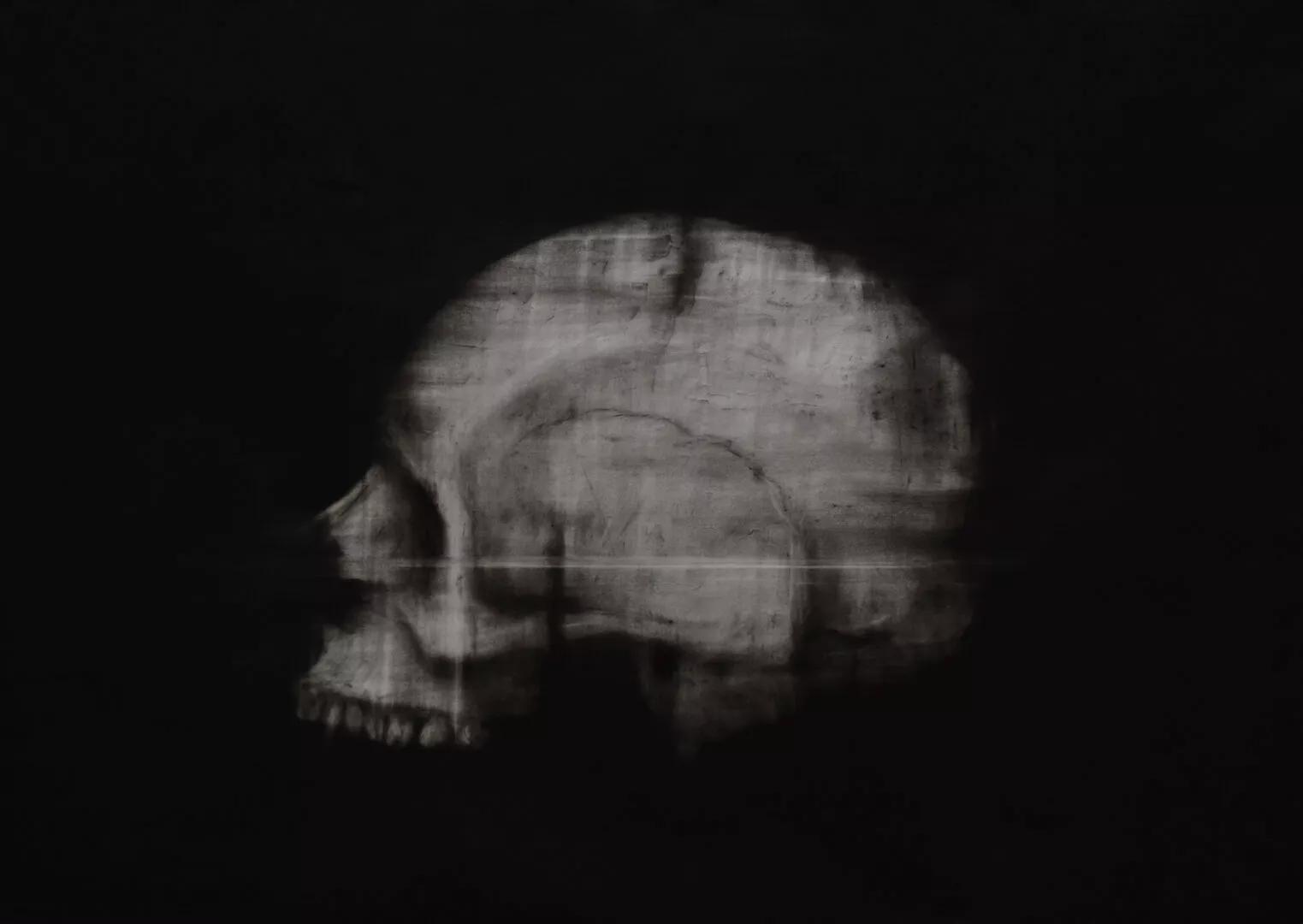 Thumbnail image for exhibition titled Impossible Relic : Schädel