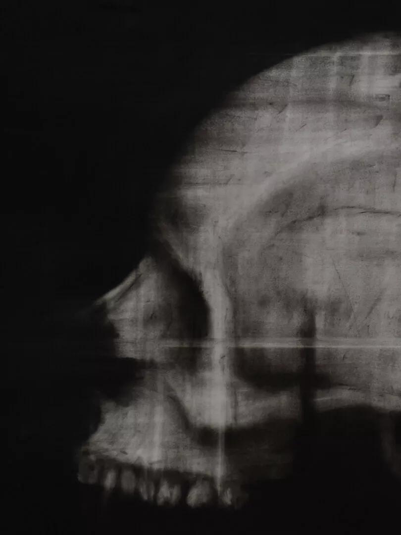 Thumbnail image for exhibition titled Impossible Relic : Schädel
